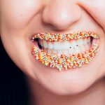 How to prevent teeth discoloration